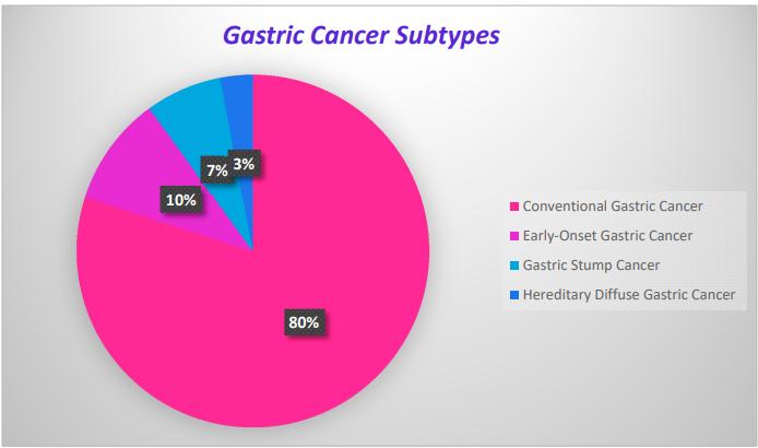 Fig.1 Classification of GC. (Machlowska, et al., 2020)