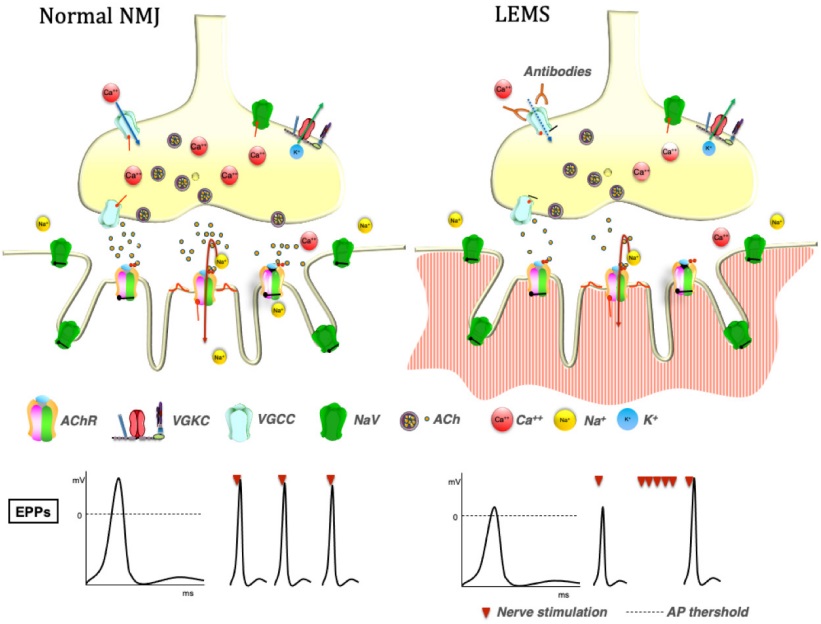 Fig.1 Pathological changes during LEMS. (Giannoccaro, Patrizia and Rocco, 2021)