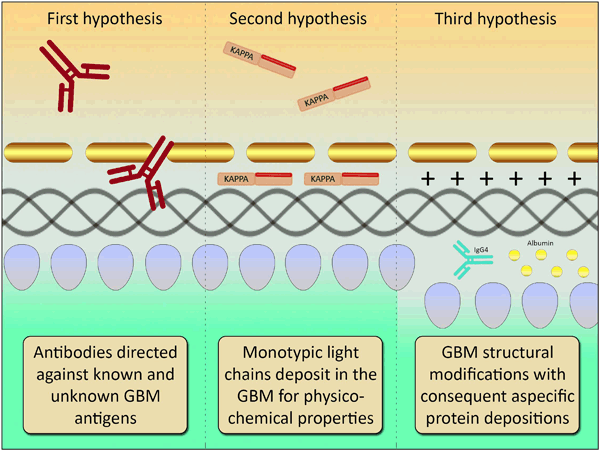 The possible mechanisms of anti-GBM attack.