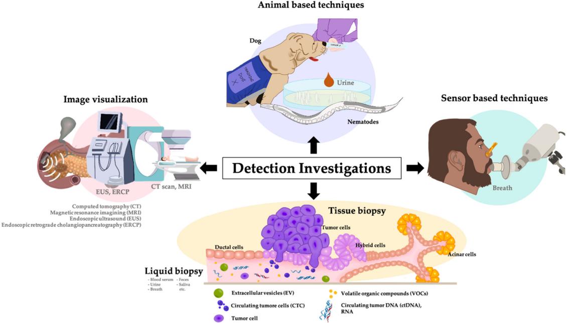 Fig.2 Overview of detection for PC. (Ungkulpasvich, et al., 2023)
