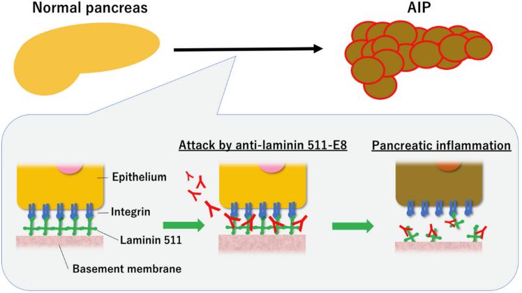 Fig.3 Pathogenesis of AIP. (Yokode, Masahiro and Yuzo, 2021)