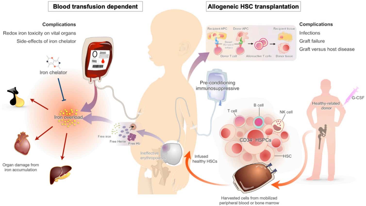 Fig.1 Treatment and complications of β-thalassemia. (Rattananon, et al., 2021)