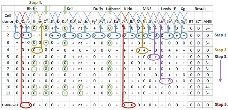 Fig.1 Detection process for antibodies to the human blood group system, including Xg. (https://commons.wikimedia.org/wiki/File:Serology_interpretation_of_antibody_panel_for_blood_group_antigens.jpg)