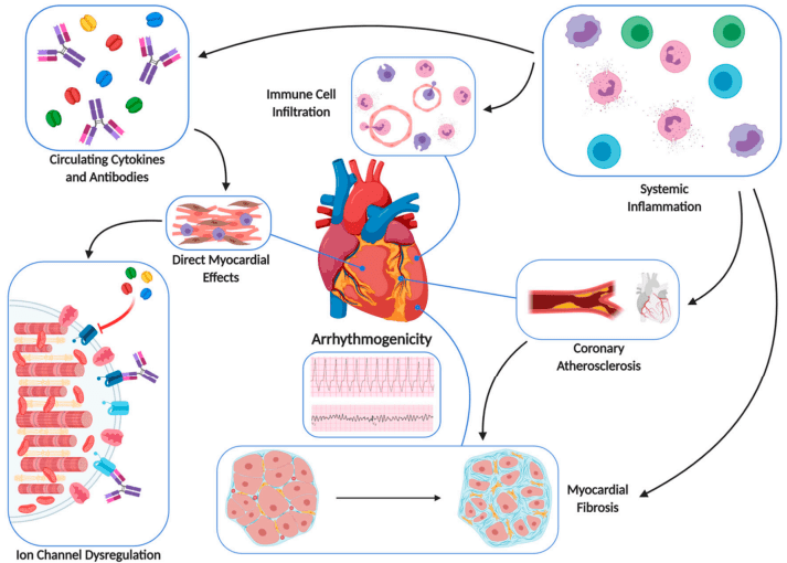 Fig.1 Different stages of myocarditis. (Błyszczuk, 2019)