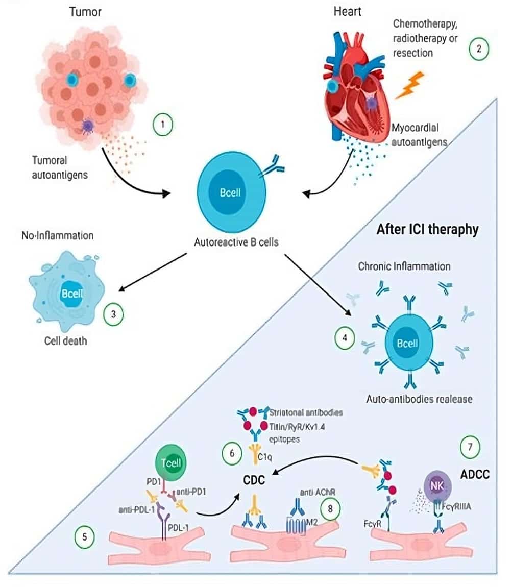 Fig.1 Autoantibody-mediated cardiac immune-related adverse events following ICI therapy. (Rubio-Infante, et al., 2022)