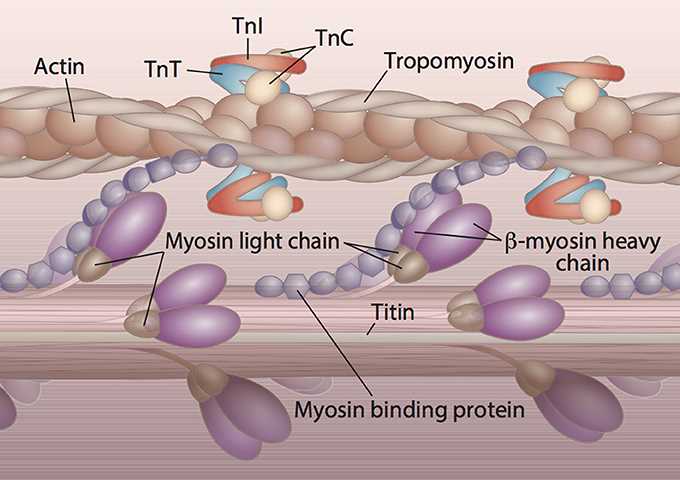Anatomical cross-sections of hearts with various forms of cardiomyopathy.