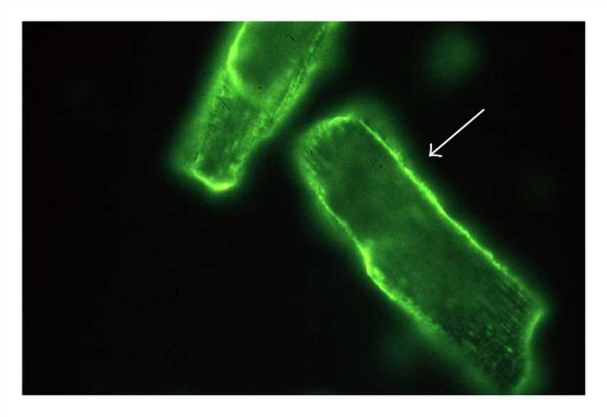 Example for the detection of antimyolemmal antibodies in pericardial fluid from a patient with chronic pericardial effusion by indirect immunofluorescence.