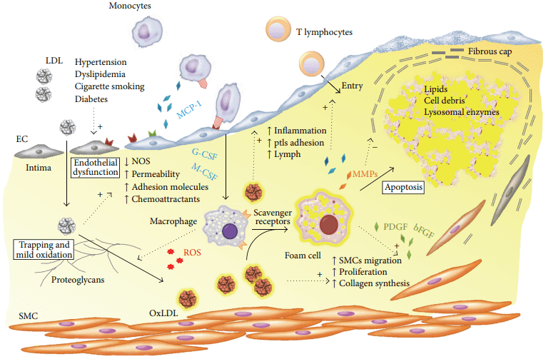 Fig.1 Role of oxLDL in the atherogenetic process. (Maiolino et al., 2013)
