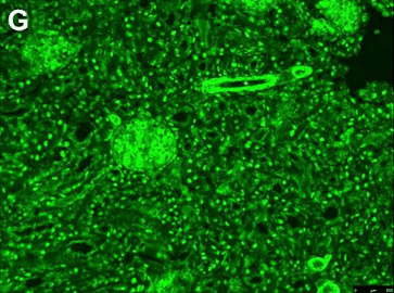 Immunofluorescence pattern of SMA on rodent kidney