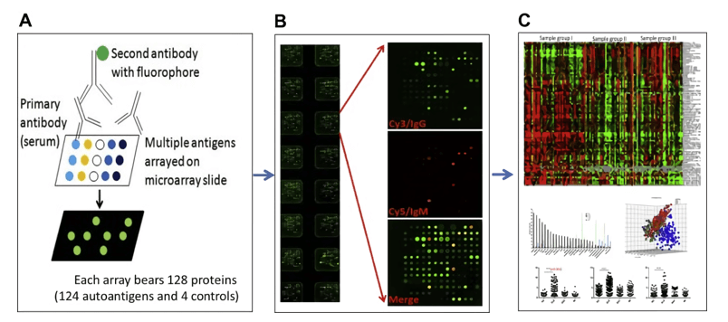 Autoantigen microarray for high-throughput autoantibody screening.