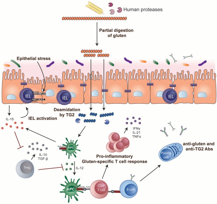 Fig.1 Key steps in celiac disease pathogenesis. (Tye-Din, et al., 2018)