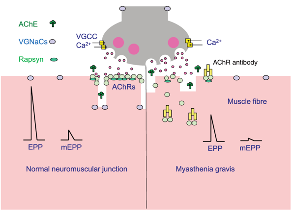  Healthy neuromuscular transmission and the MG neuromuscular junction. 