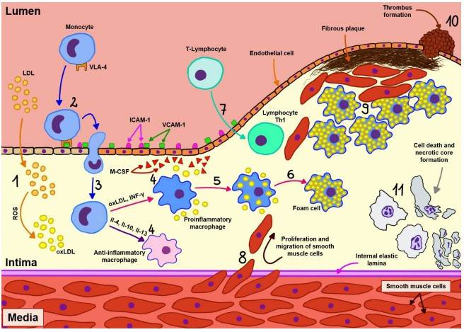 Fig.2 Pathophysiological mechanism of atherosclerosis. (Napiórkowska-Baran, et al., 2023)