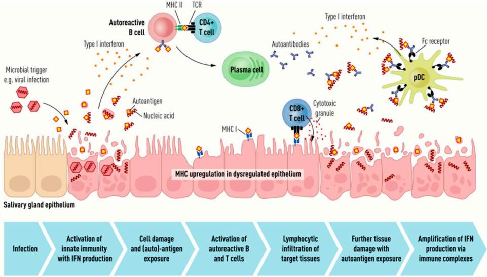 Fig.1 The pathogenetic mechanisms at the basis of Sjogren syndrome. (Kelly, et al., 2022)