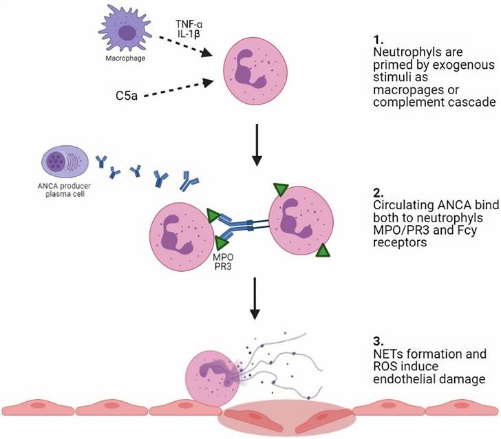 Fig.1 The inflammation cascade of ANCA-associated vasculitis. (Almeida, et al., 2021)