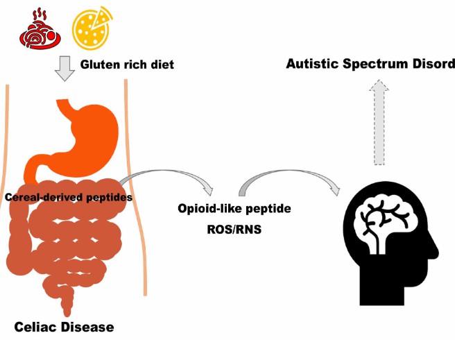Fig.2 The link between CD and autism spectrum disorder pathogenesis: interference with neurotransmission. (Di, et al., 2020)