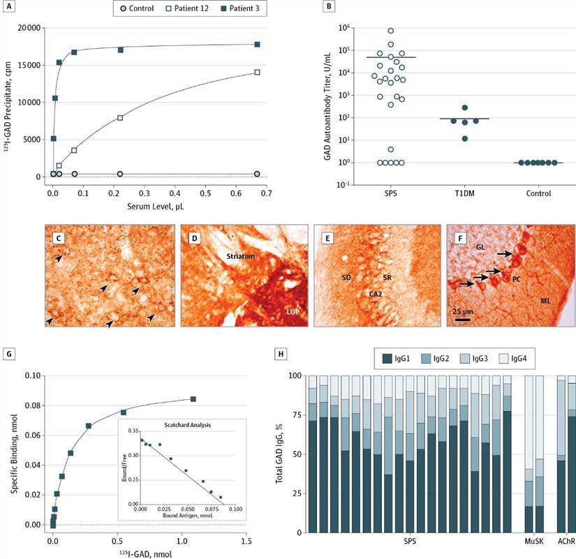 Glutamic acid decarboxylase (GAD) autoantibody characteristics and immunohistochemical staining of rat brain sections with stiff person syndrome (SPS) serum.