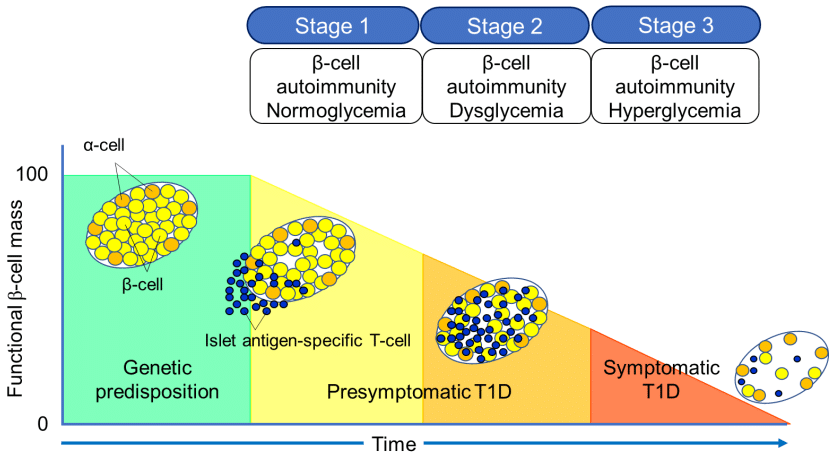 Fig.1 Stages of type 1 diabetes. (Kawasaki, 2023)
