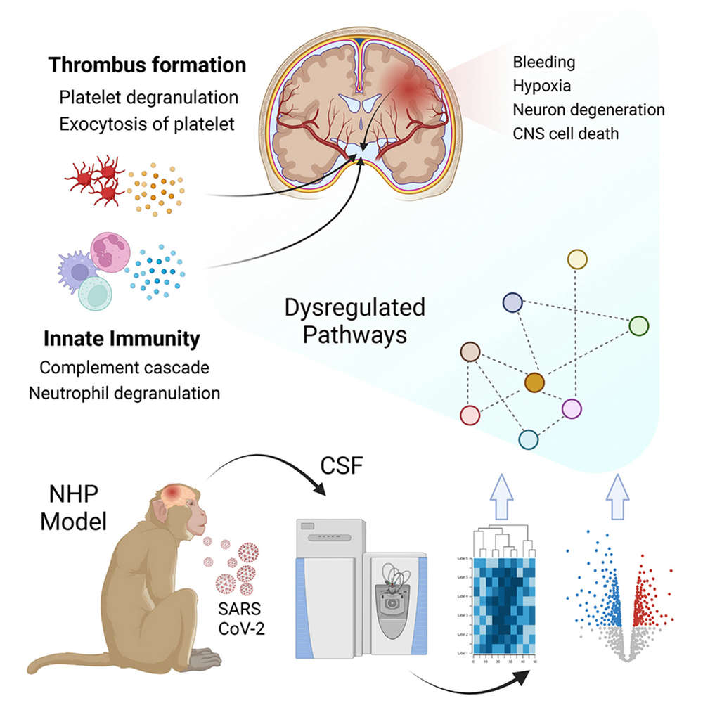 Collection of NHP cerebrospinal fluid and its application in SARS-CoV-2 treatment. (OA Literature)