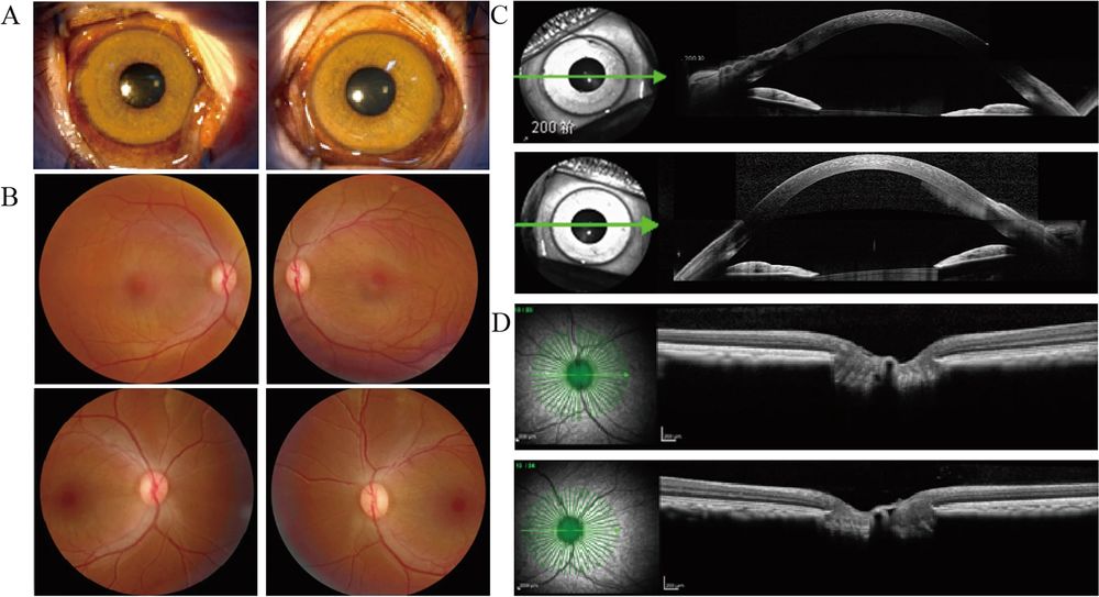 The photos of a health female monkey aged 19, including silt-limp photos, colorful fundus photos, anterior segment OCT photos and posterior segments OCT photos. (OA Literature)