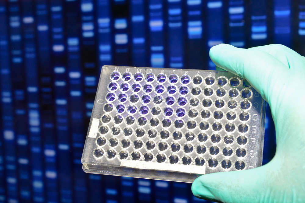 ADA testing. (Creative Biolabs Authorized)