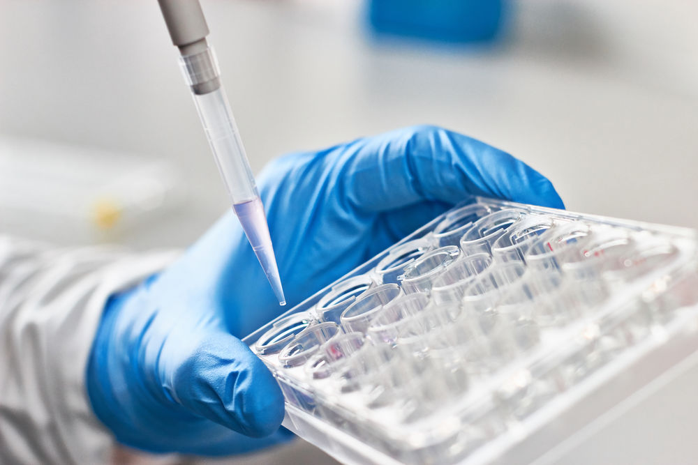 Biomarker profiling test. (Creative Biolabs Authorized)