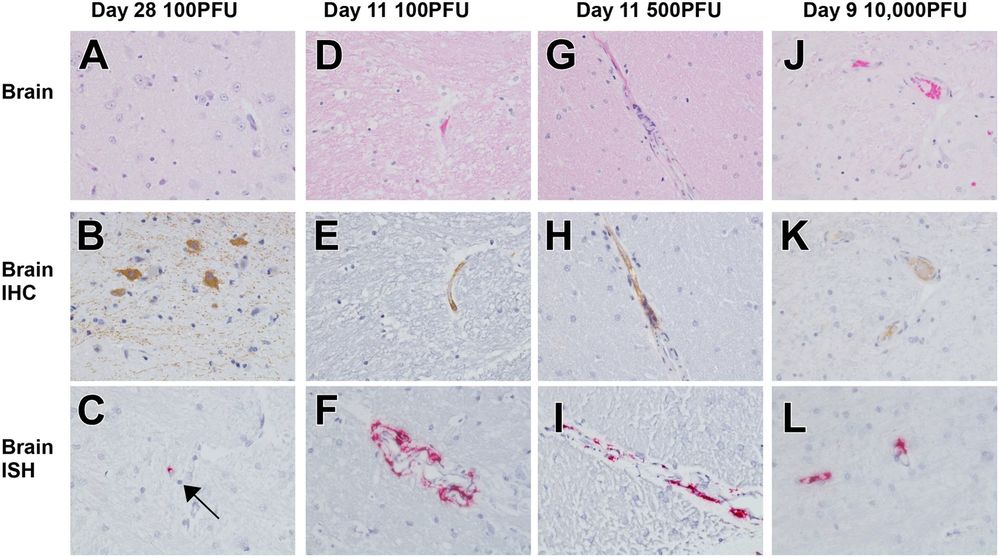 Representative histologic lesions in the brain of cynomolgus macaques infected with EBOV Makona variant via conjunctival route. （OA Literature）