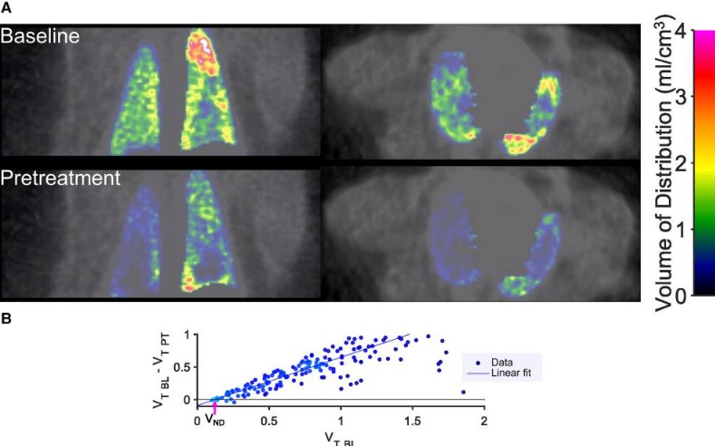 Sample results of quantification of drug binding and occupancy in lung in non-human primate. (OA Literature)