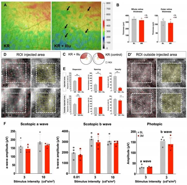 Optogene-mediated retinal degeneration in the NHP retina. (OA Literature)