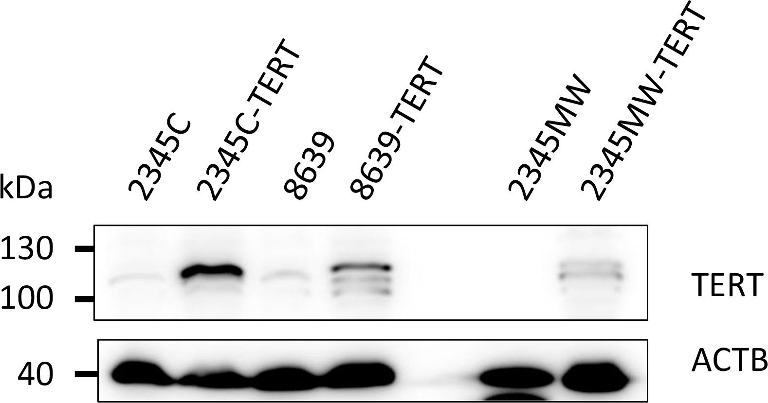 Immortalized kidney cells express the immortalization gene TERT.