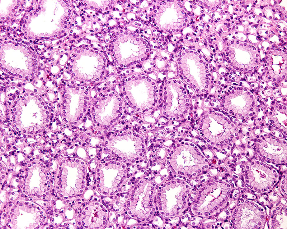 Non-Human Primate (NHP) Kidney Cell Line Products, Vervet Monkey,  Kidney Cell Line