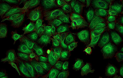 Immortalized GFP-Expressing NHP Endothelial Cell Products, Cynomolgus Monkey,  Immortalized GFP Expressing Endothelial Cells