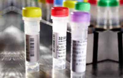 NHP cDNA-Random Primer Products, Cynomolgus Monkey, cDNA-Random Primer