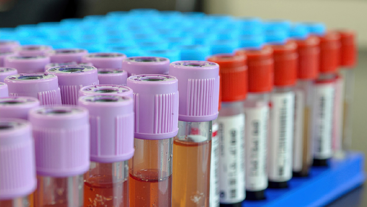 Fig.3 NHP Biospecimen Custom Collection Service. (Creative Biolabs Authorized)