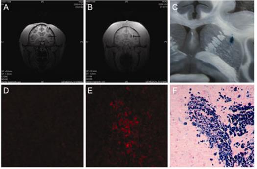 Multimodality imaging of MIRB-labeled cMSCs.