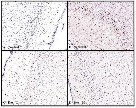 Activated caspase 3 (AC3) immunostained photomicrographs of the frontal cortex of fetal monkey brains of untreated control(A) and monkeys treated with ketamine (B), low-dose dexmedetomidine (C), and high-dose dexmedetomidine. The AC3-positive cells shown in Fig. 2B can be clearly seen in Fig. 3B. 20X magnification.