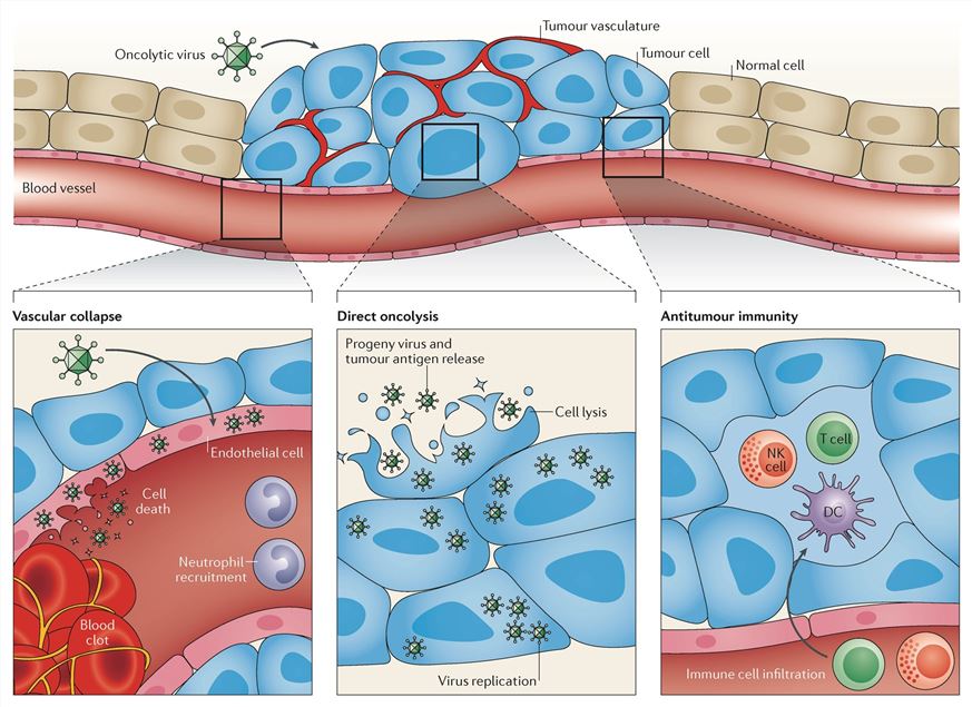 Mechanisms of oncolytic-virus-based cancer therapy.