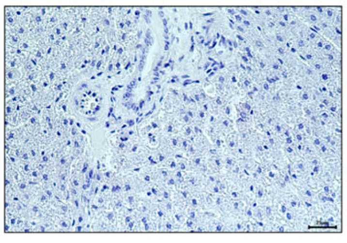 The liver tissue is stained by immunohistochemical staining. (OA Literature)