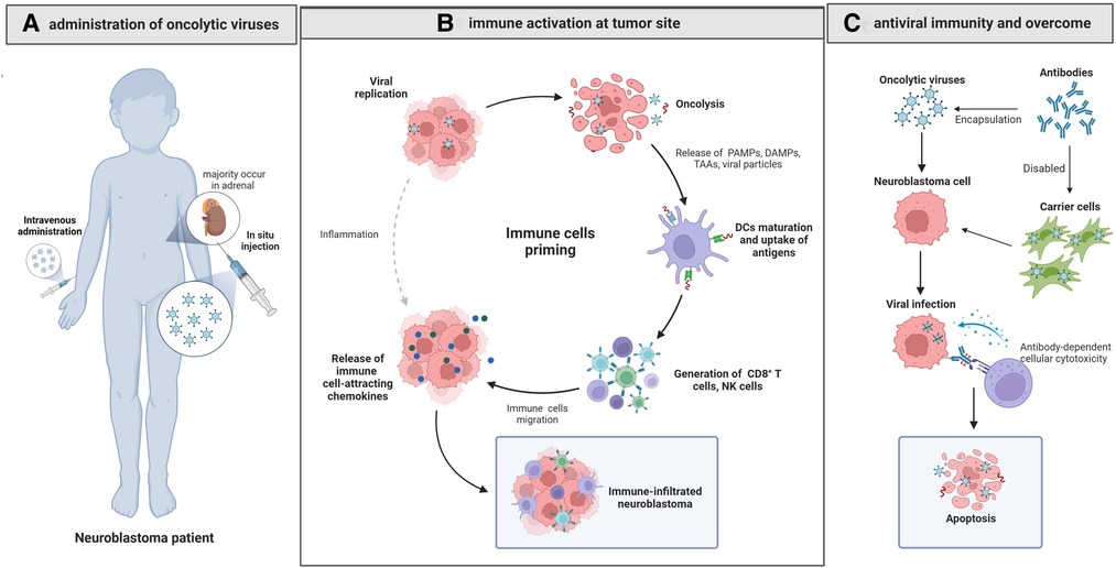 Current oncolytic virotherapy for neuroblastoma. (OA Literature)