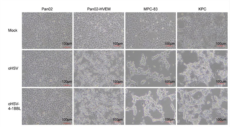 Cytopathic effect caused by viral infection. (OA Literature)