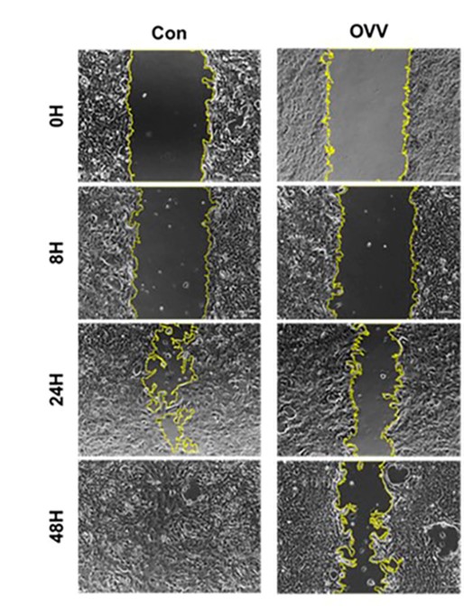 The migration ability of tumor cells was detected by scratch test. (OA Literature)