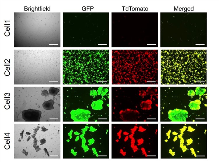 Fluorescence microscopy is used to observe the infection of oncolytic virus to lung cancer cells. (OA Literature)
