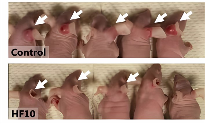 Oncolytic virus reduces tumor volume in a mouse model of head and neck cancer. (OA Literature)