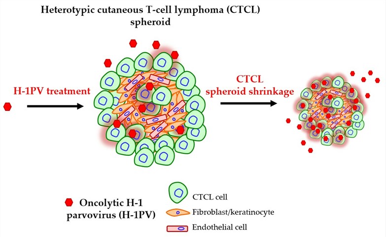 Mechanisms for the use of oncolytic viruses in the treatment of cutaneous T-cell lymphom. (OA Literature)