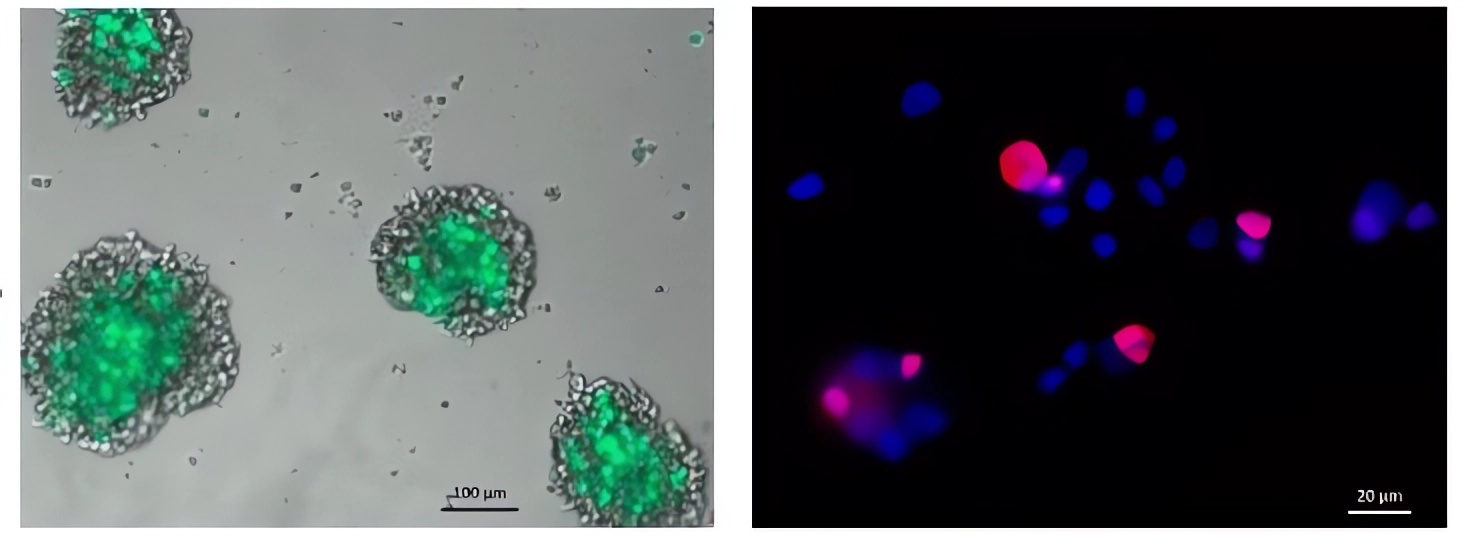 When the oncolytic virus successfully infects the tumor cells, it will emit green fluorescence. (OA Literature)