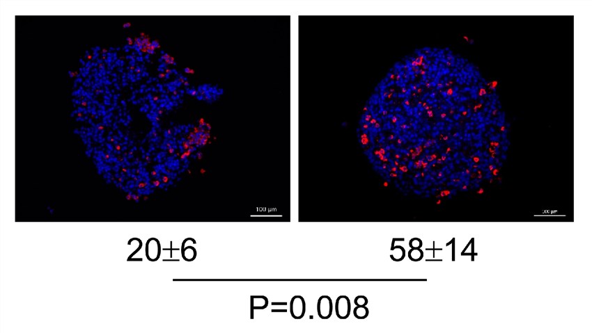 Oncolytic viruses can increase the infiltration of CD8-positive T cells into tumor tissues. (OA Literature)