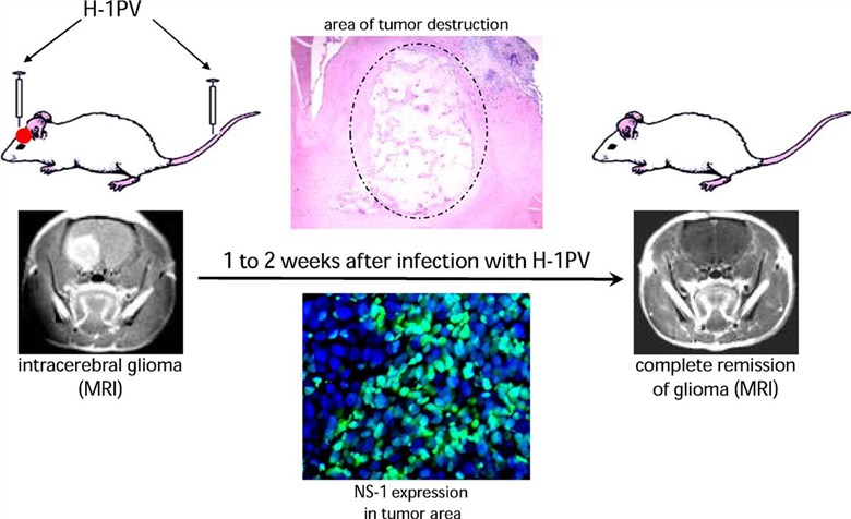 Schematic illustration of the anti-glioma activity of H-1PV in rat models.