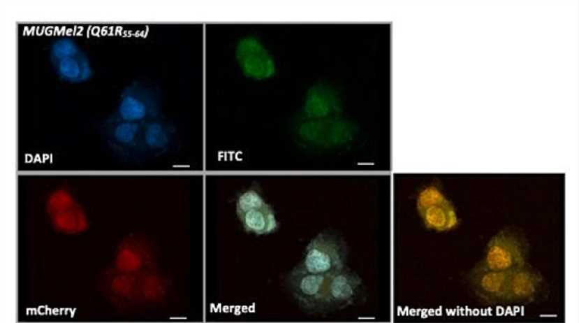 Oncolytic virus internalization was assessed by confocal microscopy together at different time points after treatment.