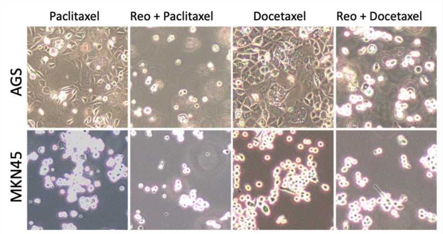 The growth of tumor cells was observed under a microscope. (OA Literature)
