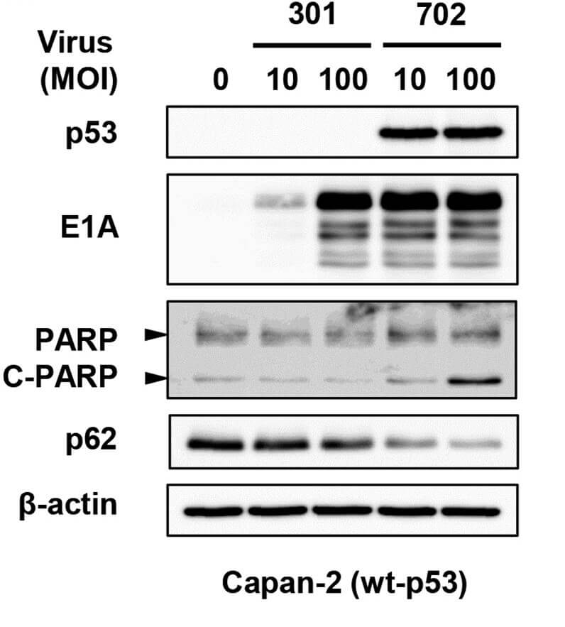 OBP-702 induces p53-mediated apoptosis and autophagy in human PDAC cells. (OA Literature)